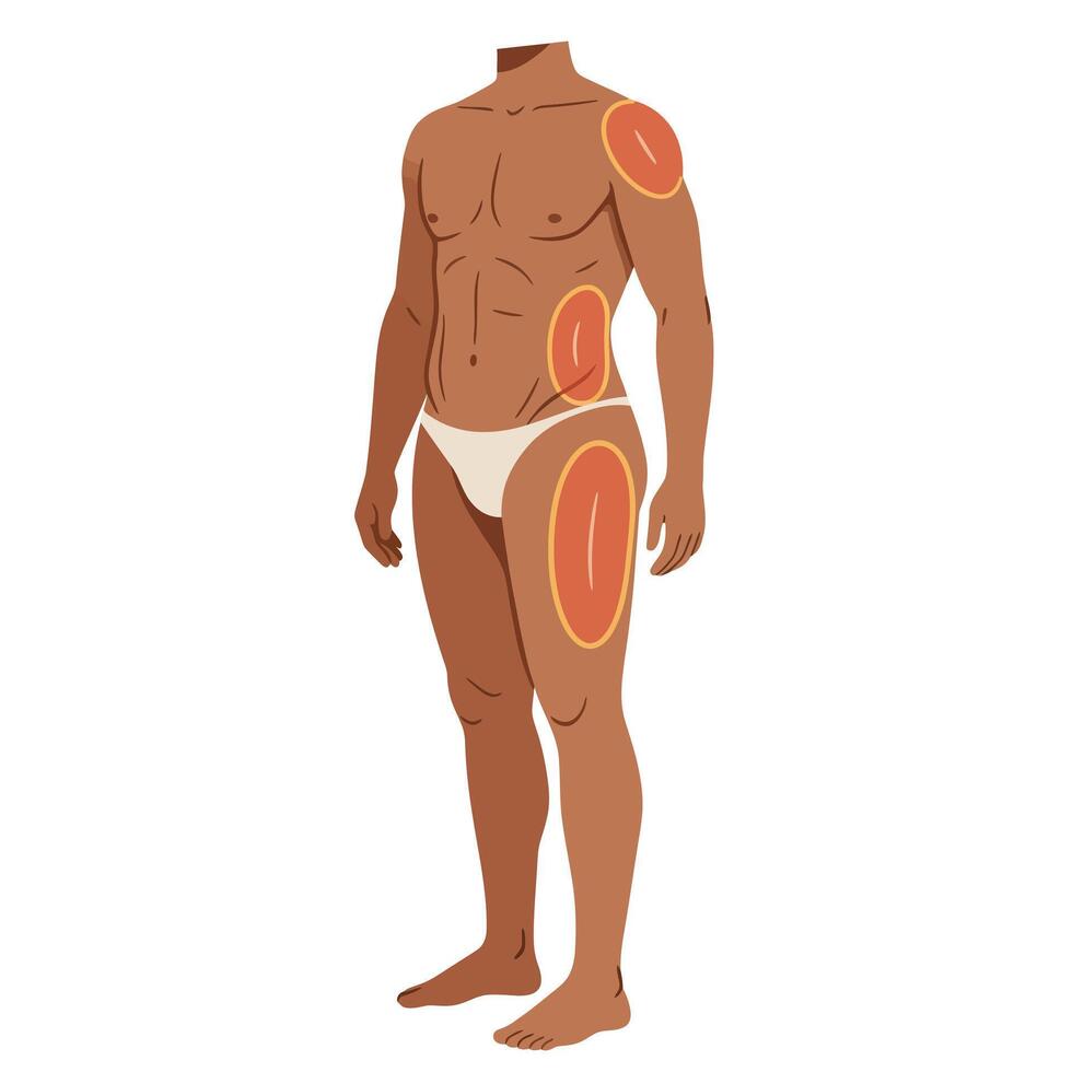 A Diverse Race Male With Marked Areas for Liposuction vector