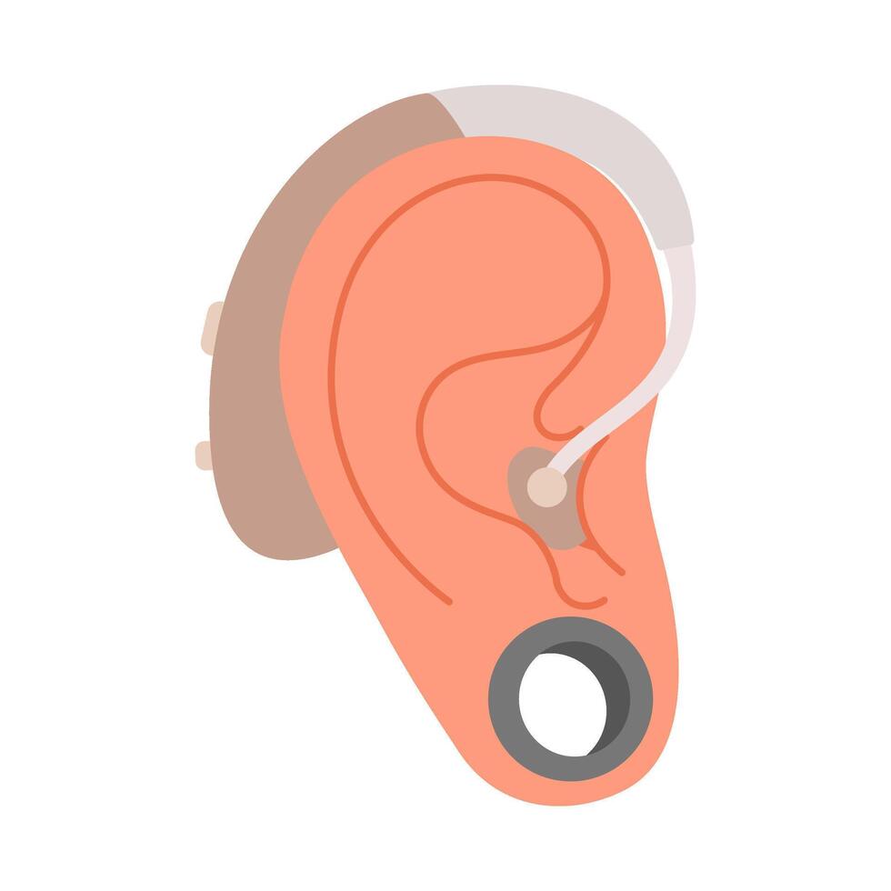 Human ear with attached hearing aid. Hand drawn flat style isolated icon. Inclusion and diversity. Digital hearing aid, Neuroprosthesis for deaf person. Hearing loss treatment and prosthetics vector