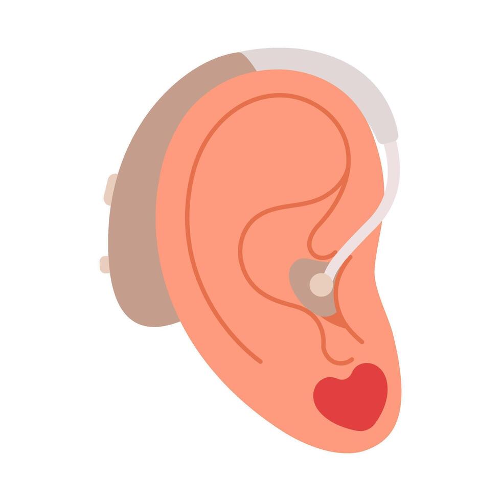 Human ear with attached hearing aid. Hand drawn flat style isolated icon. Inclusion and diversity. Digital hearing aid. Neuroprosthesis for a deaf person. Hearing loss treatment and prosthetics vector