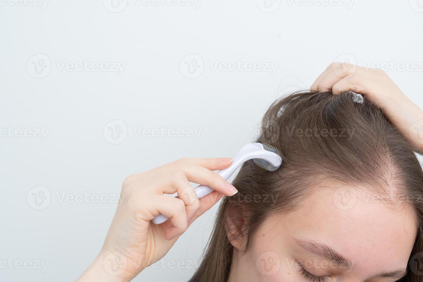 Close up of brunette woman using microneedling derma roller on scalp for stimulating new hair growth, copy space. Alopecia treatment, scalp stimulation, hair loss and baldness targeted therapy. photo