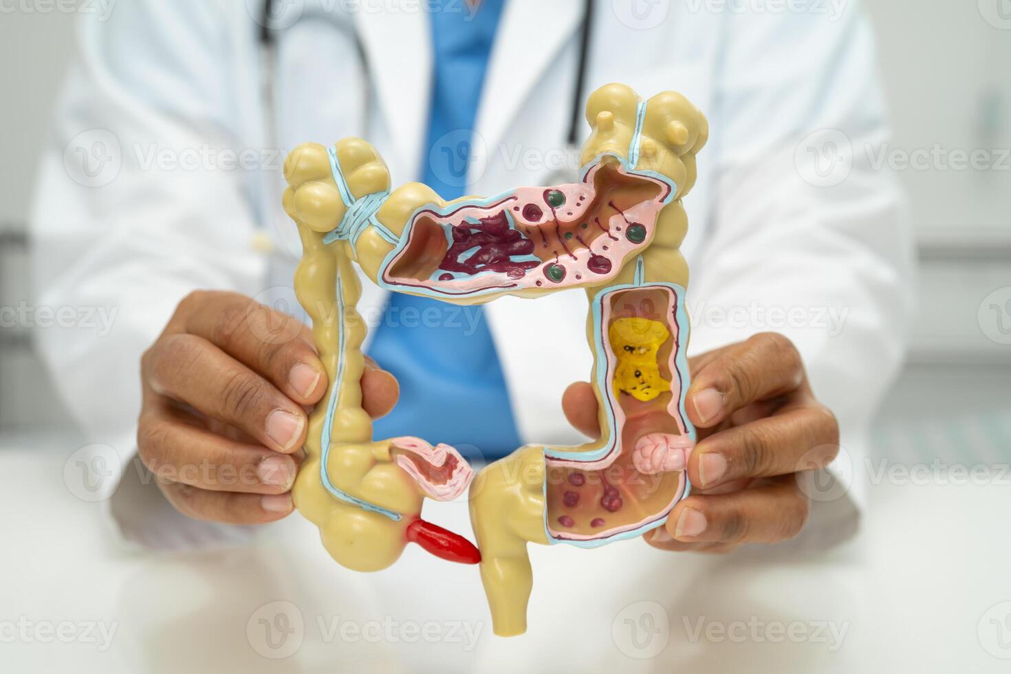 Intestine, appendix and digestive system, doctor holding anatomy model photo
