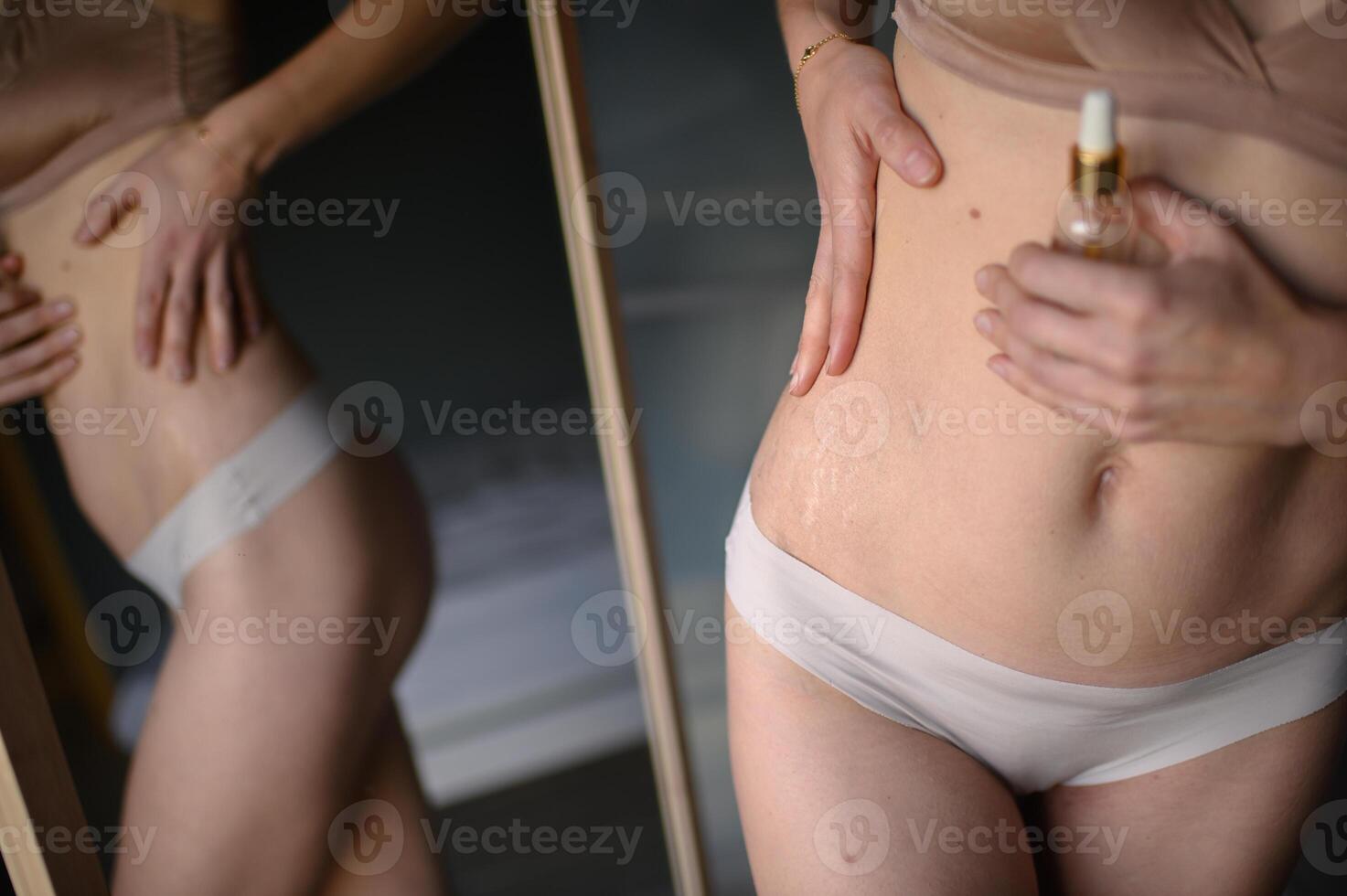 With slow, gentle movements, she massages oil into her stretch marks for hydration. photo