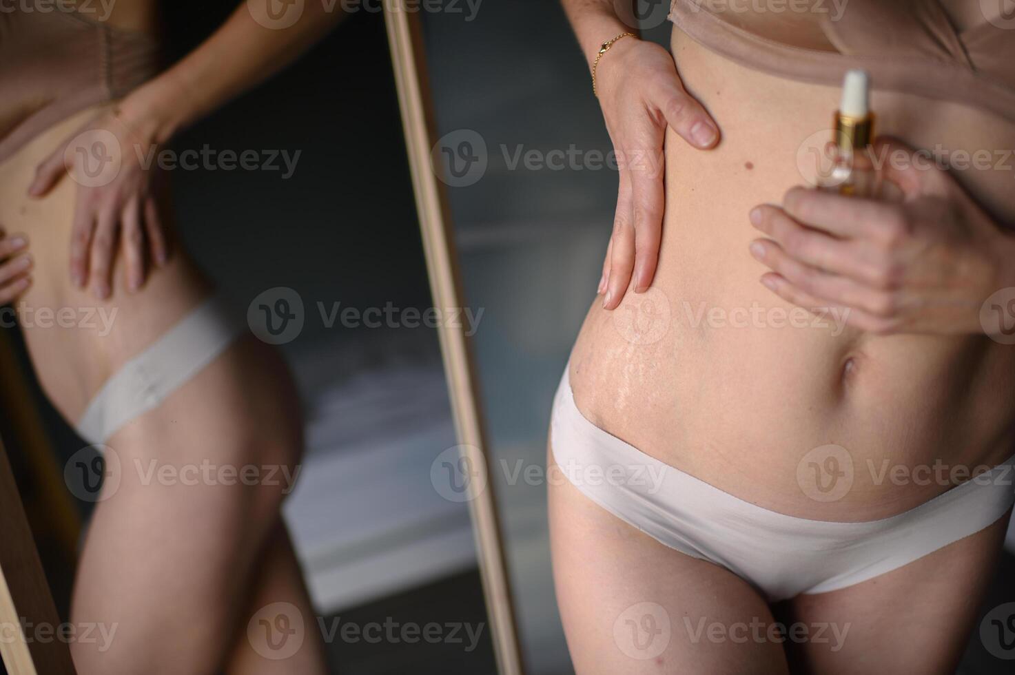 A close up shows stretch marks on a womans stomach as she holds a small bottle of oil in womans hand. photo