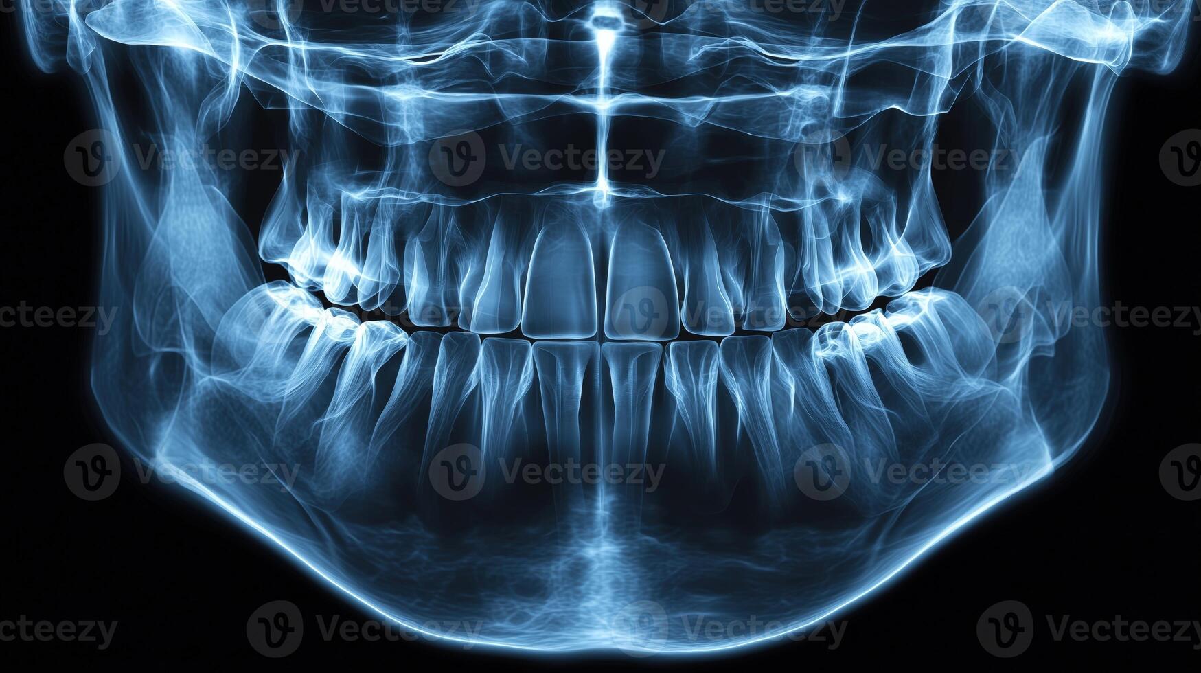 X-ray image of human jaw and teeth showing dental structures photo