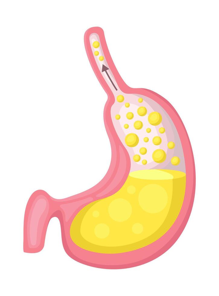 A detailed representation of the human stomach anatomy along with the depiction of digestive fluids vector