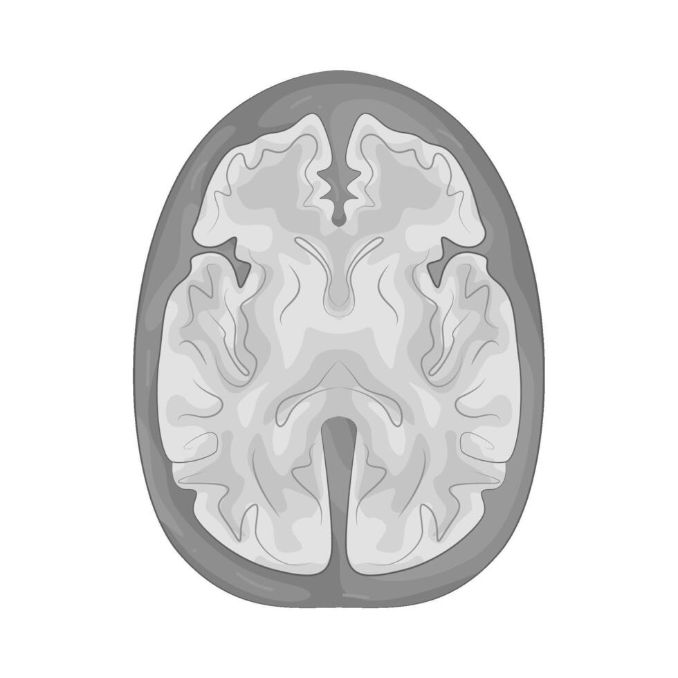 Illustration of MRI Scan vector