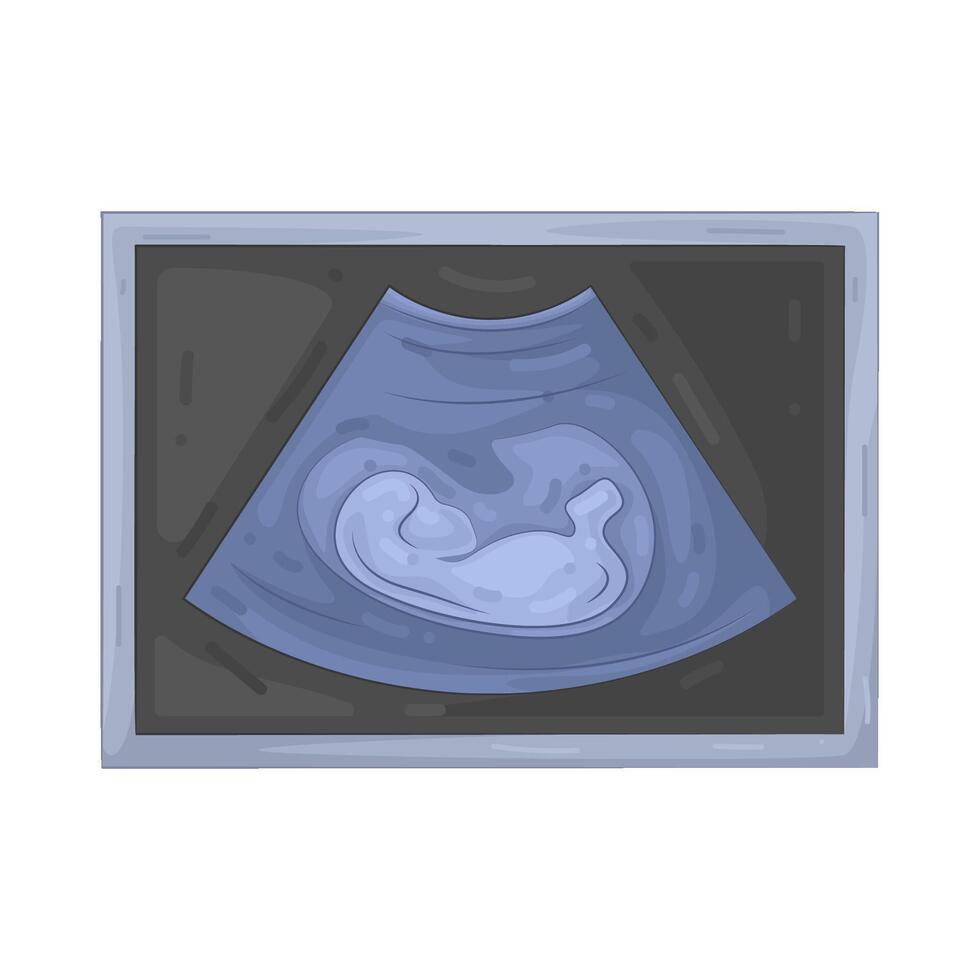 Illustration of Fetal Ultrasound vector