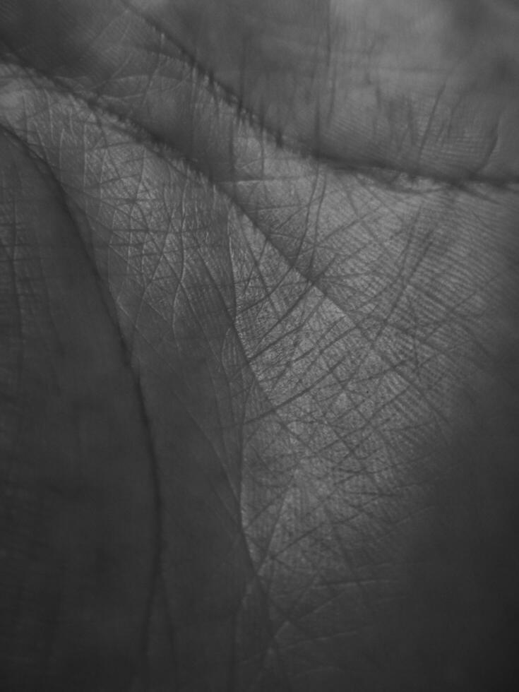 Black background. texture of hand skin. Medical concept. perfect for advertisements, cosmetic, beauty, sport, skin care, dermatology photo