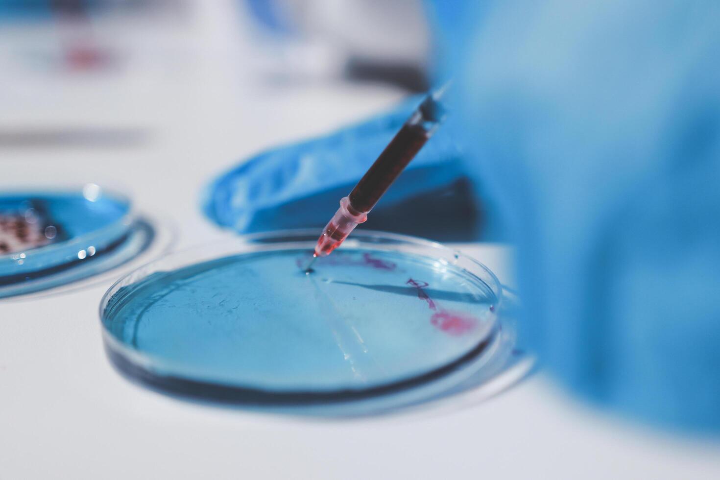 A person in blue gloves is holding a syringe photo