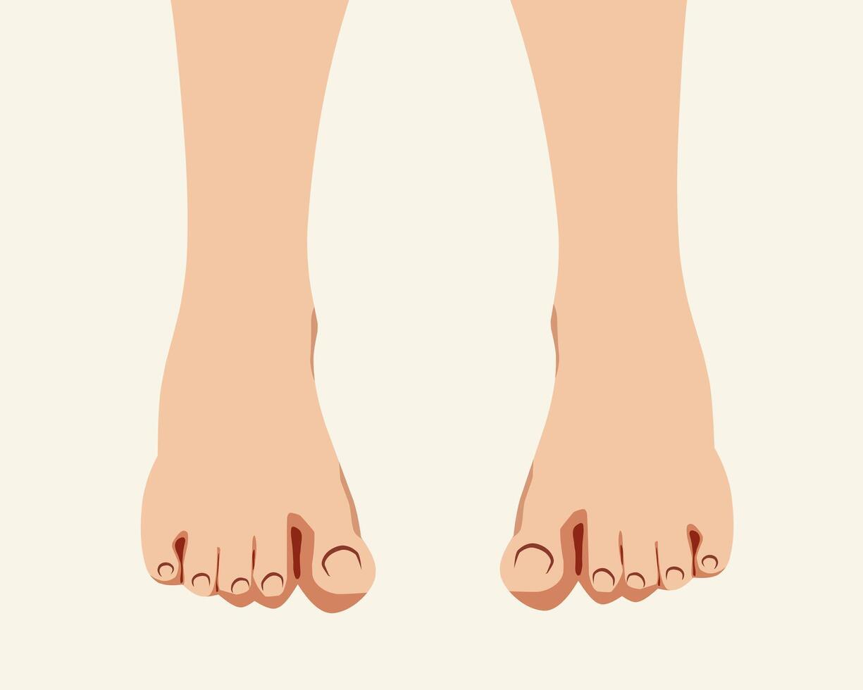 illustration of human feet seen from above. Ideal for educational materials, health-related designs, and anatomical studies. Isolated and detailed vector