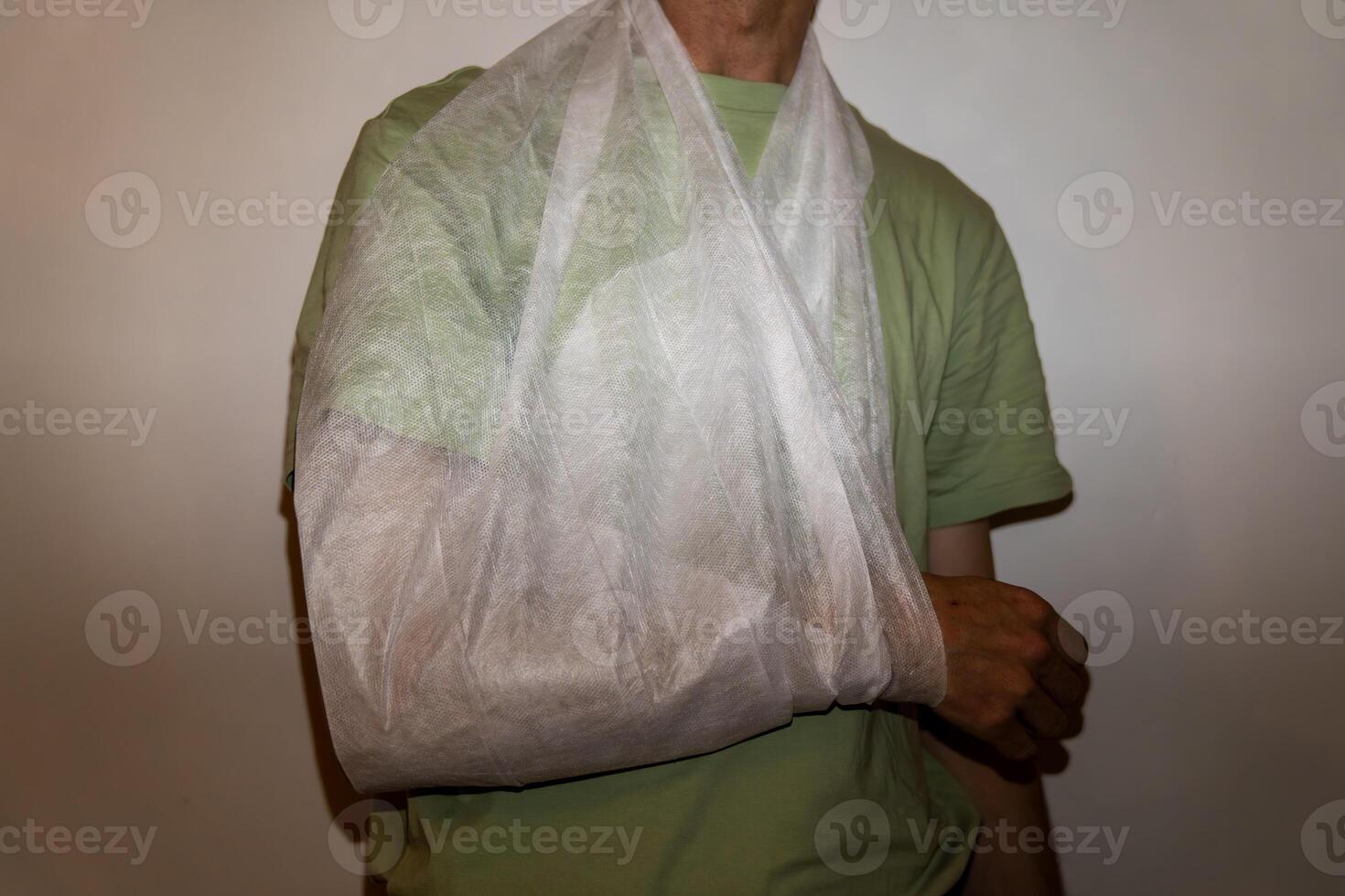 Right hand injury photo