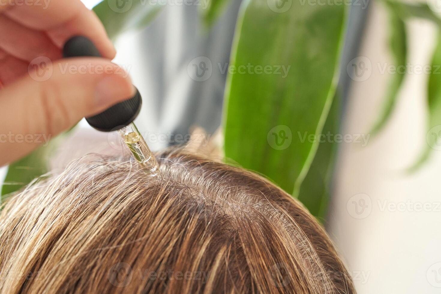 Close up of hair care routine with serum application on female caucasian scalp with dropper. photo