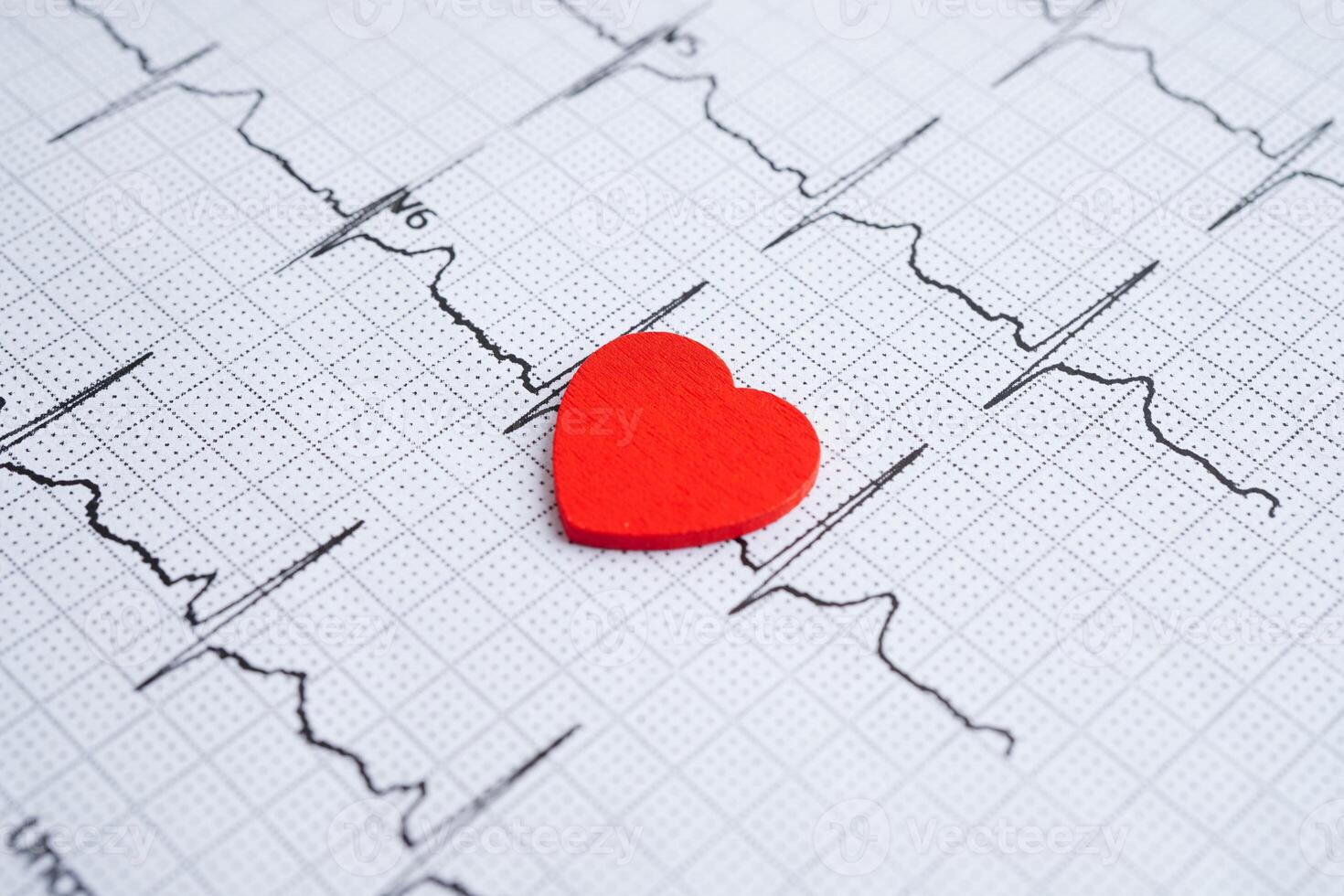 Electrocardiogram ECG, heart wave, heart attack, cardiogram photo