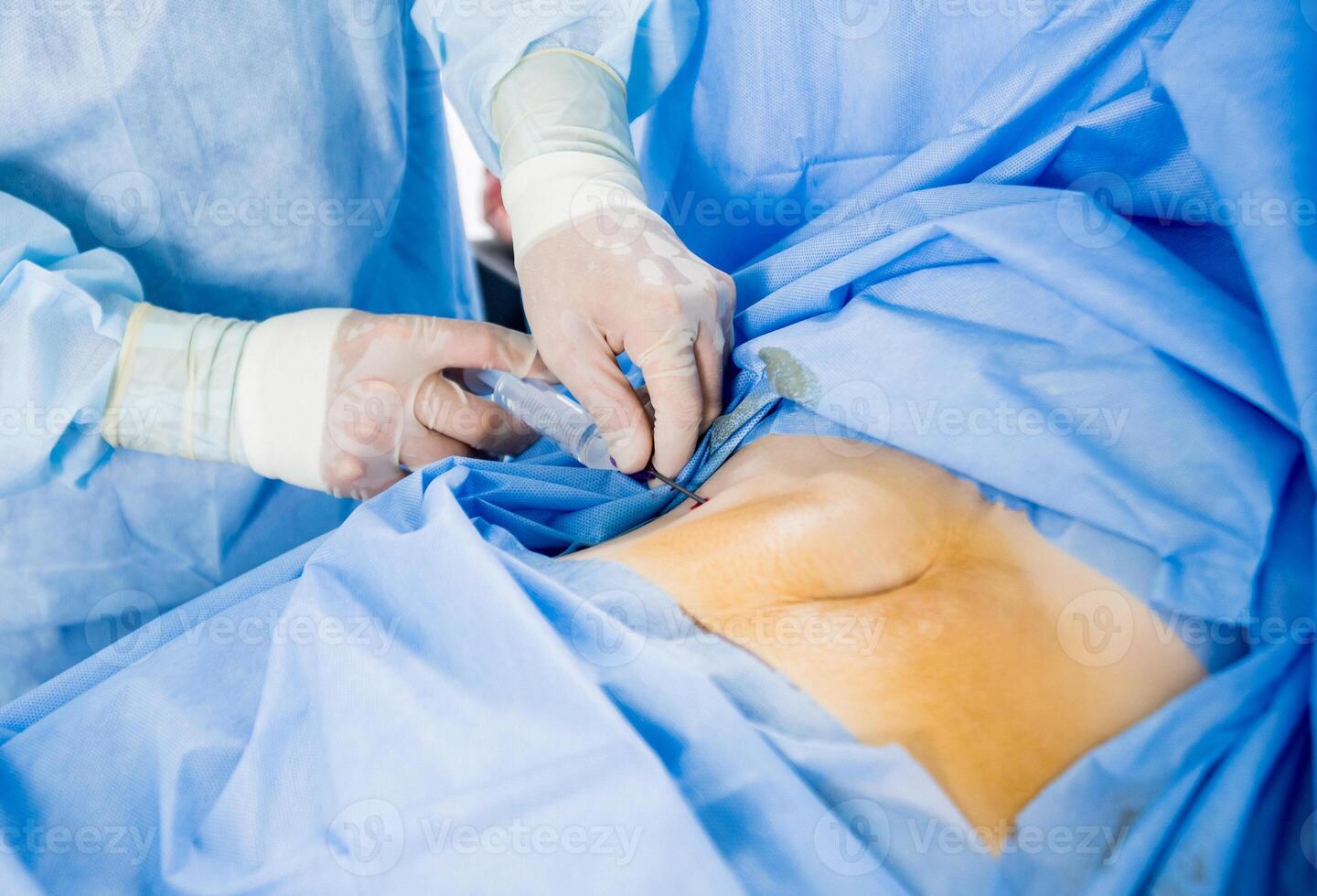 Arthroscope surgery. Orthopedic surgeons in teamwork in the operating room photo