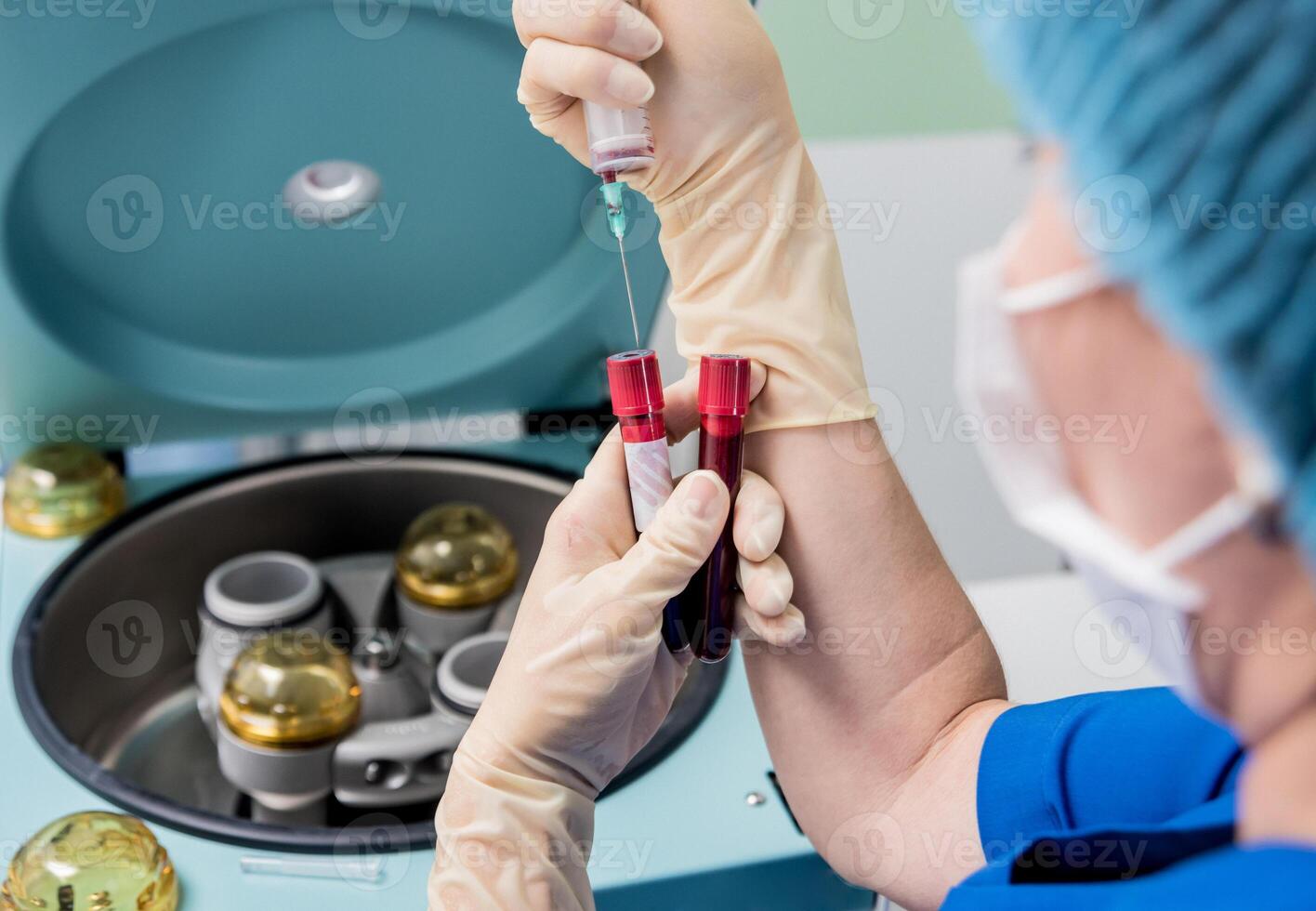 Platelet-Rich plasma preparation. Plasma in syringe. Centrifuge. photo