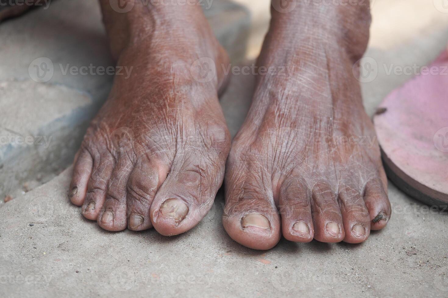 Barefoot figures resting on a rough surface in natural light photo