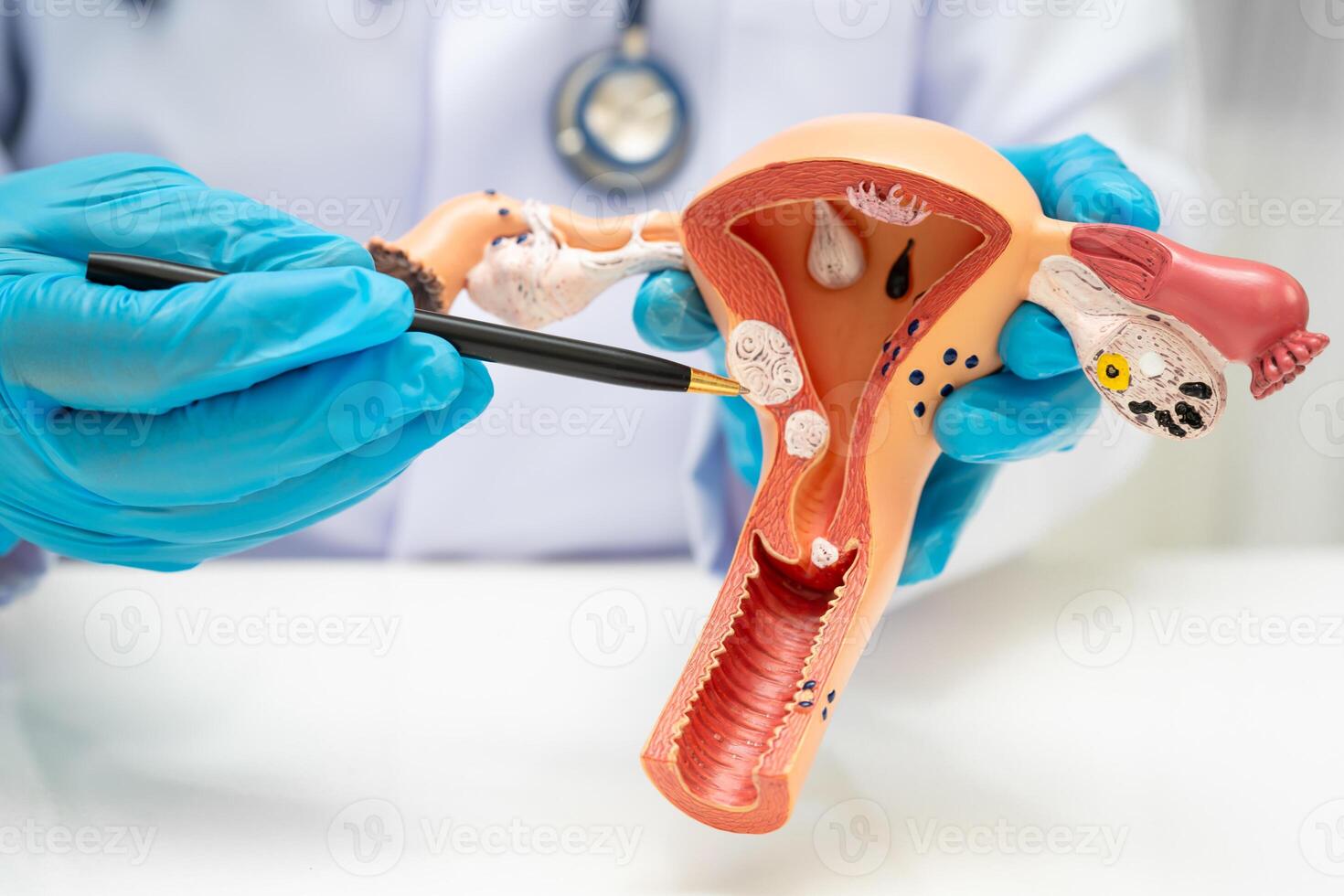 Uterus, doctor holding human anatomy photo