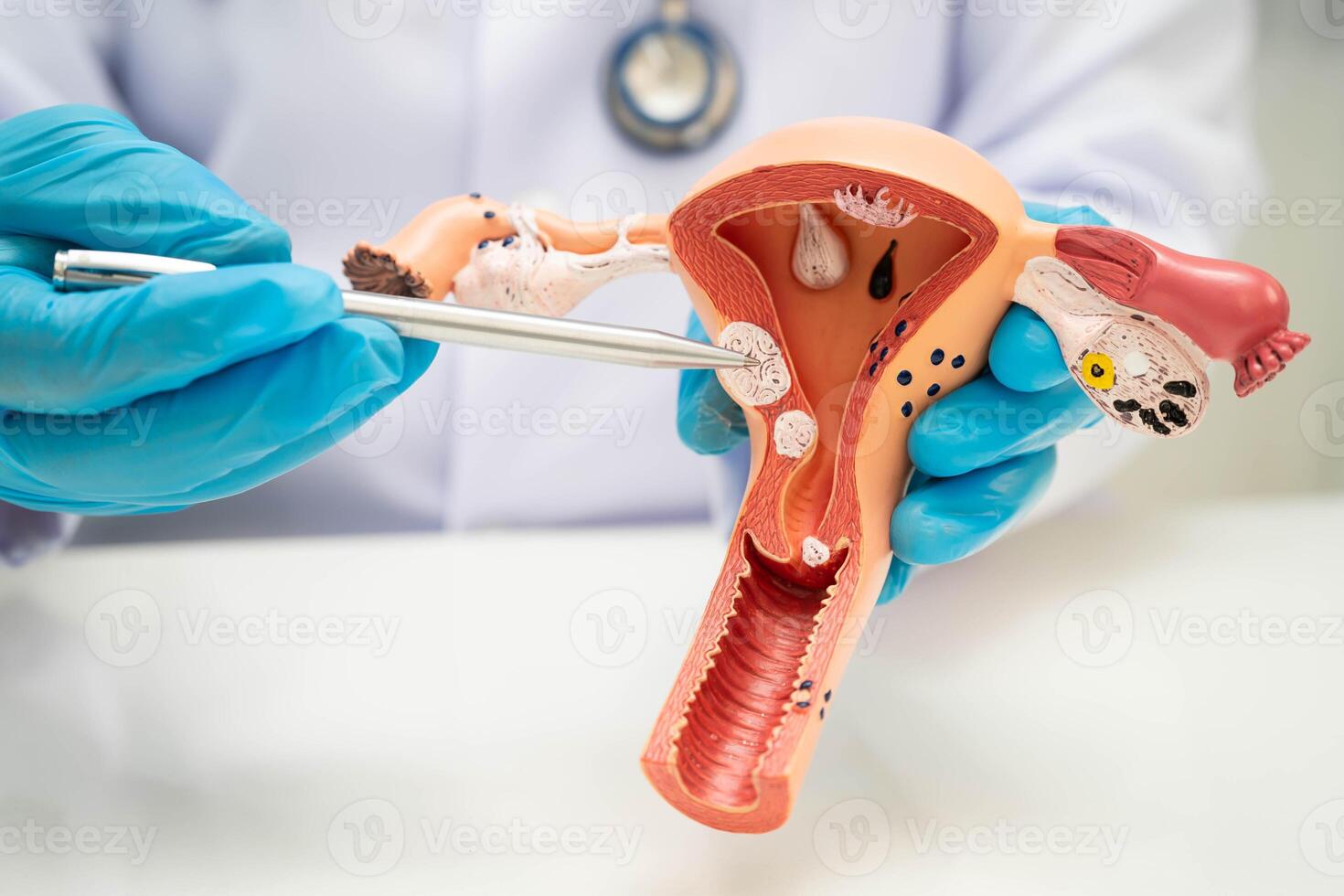 Uterus, doctor holding human treatment photo