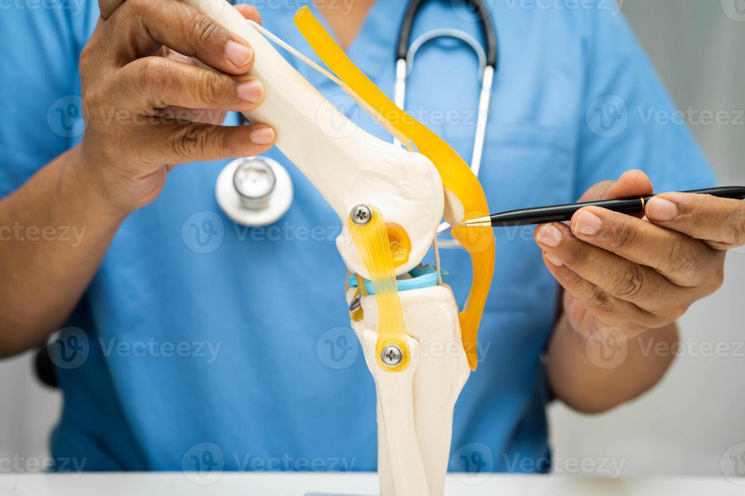 doctor holding spinal nerve and bone model, Lumbar spine displaced herniated disc fragment photo