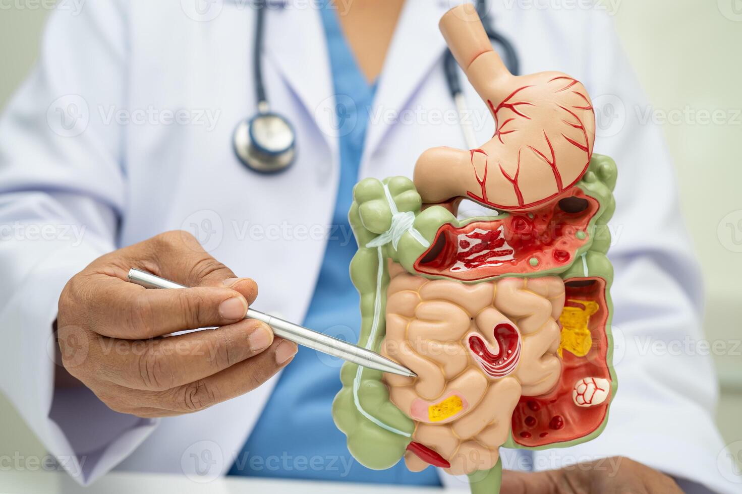 Digestive system with stomach and intestine, Asian doctor holding human anatomy model for study diagnosis photo
