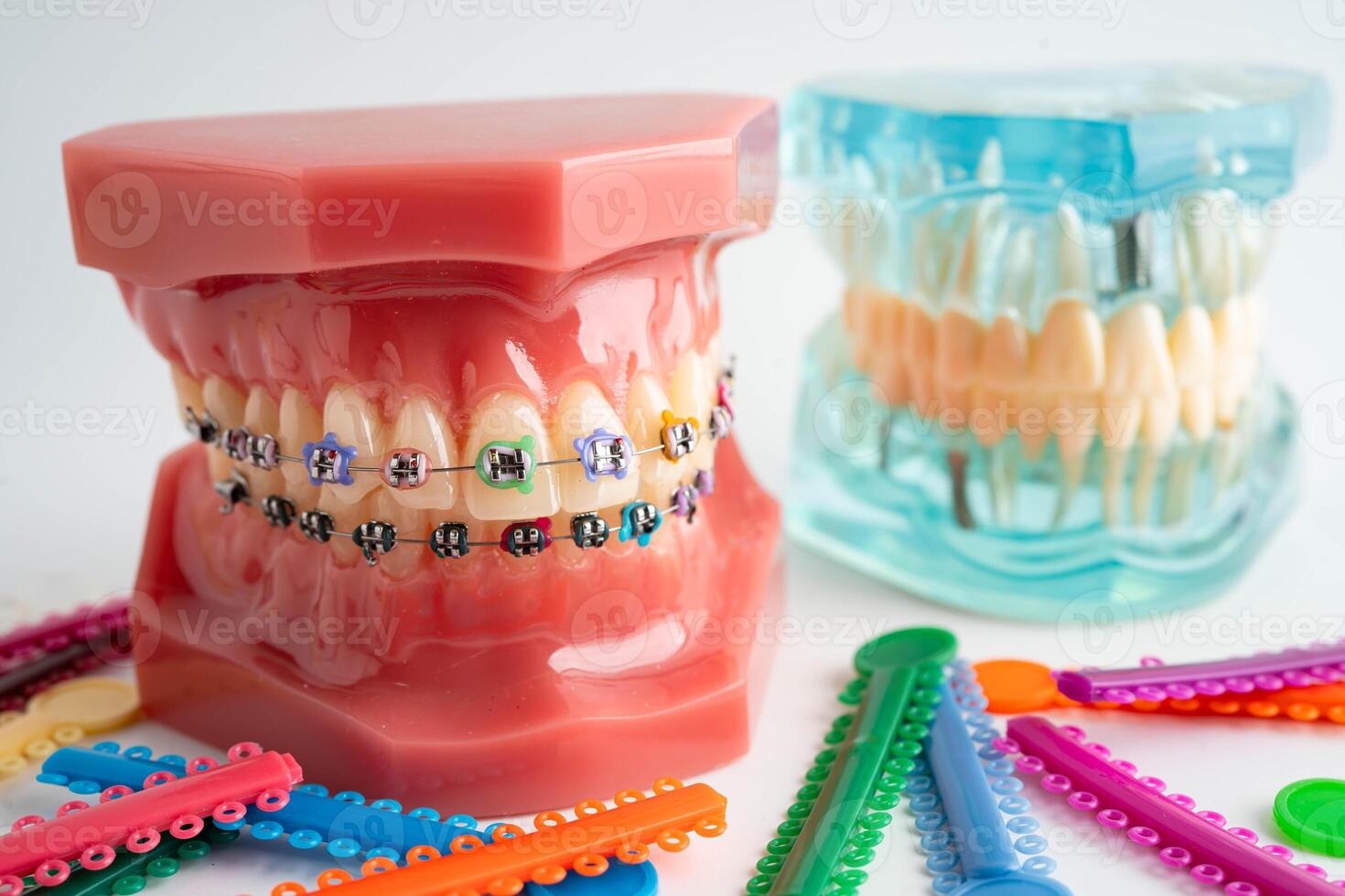 Orthodontic ligatures rings and ties, elastic rubber bands on orthodontic braces, model for dentist photo