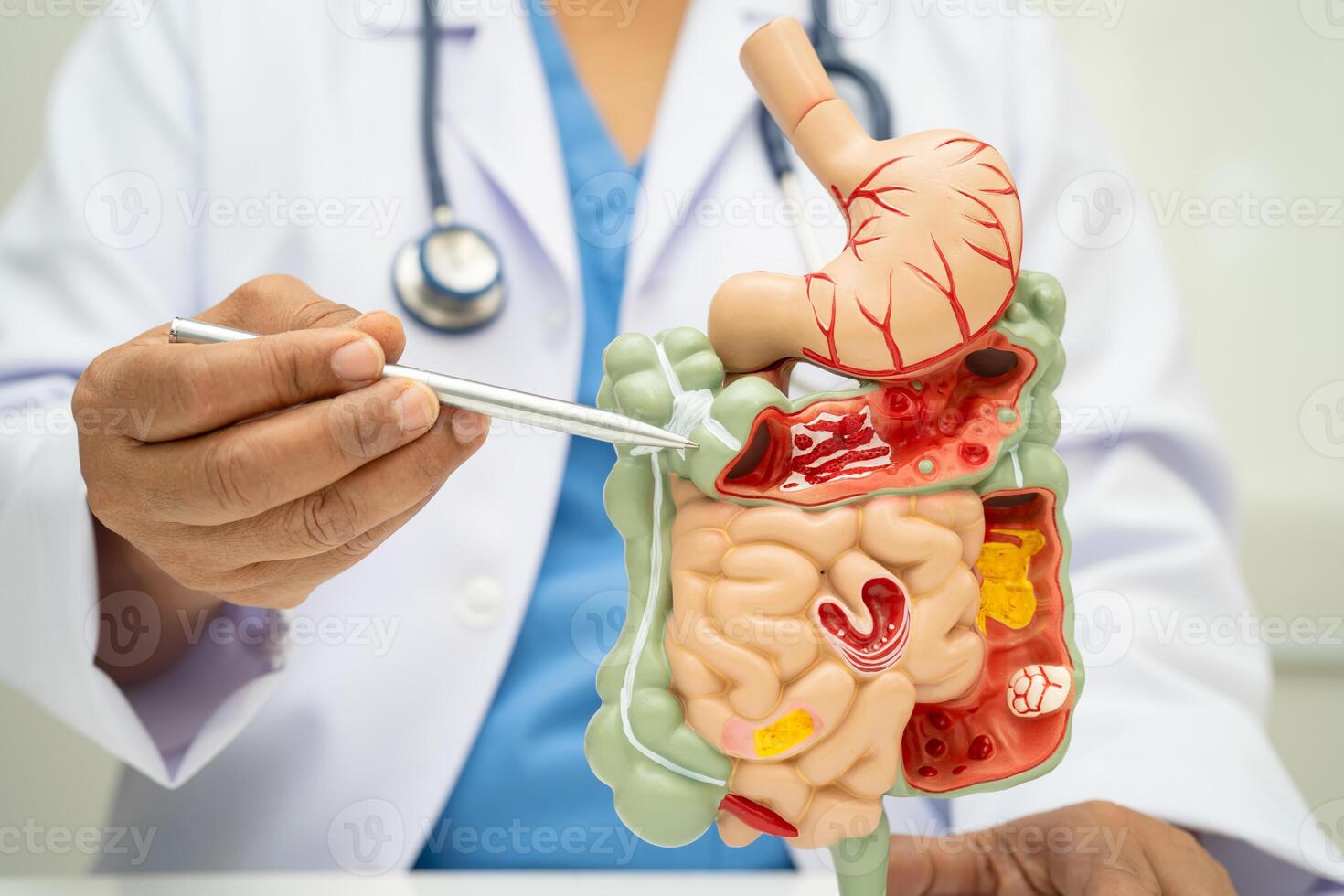 Digestive system stomach photo