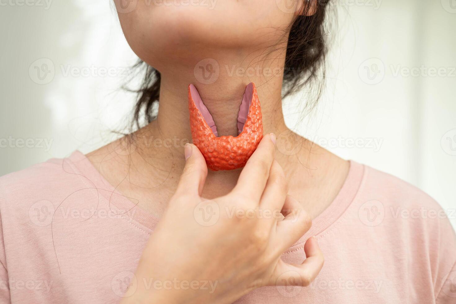 Hyperthyroidism, Overactive Thyroid, Thyroid Lymphoma, Asian woman with thyroid gland human anatomy model. photo