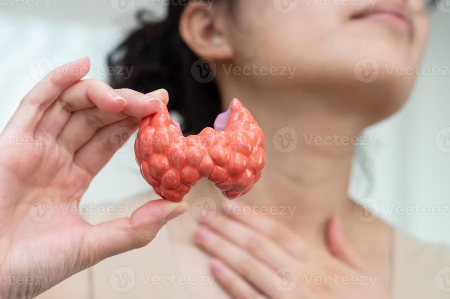 Hyperthyroidism, Overactive Thyroid, Thyroid Lymphoma, Asian woman with thyroid gland human anatomy model. photo