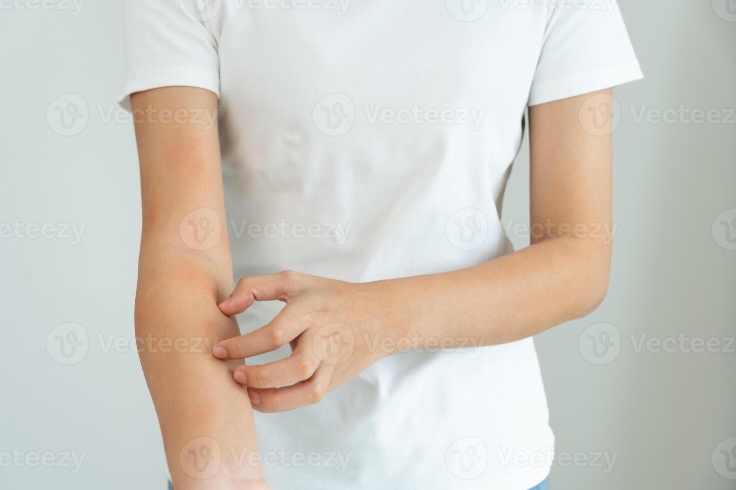 beauty. Young woman scratch body has itchy skin from skin allergic, steroid allergy, sensitive skin, red from sunburn, chemical allergy, rash, insect bites photo