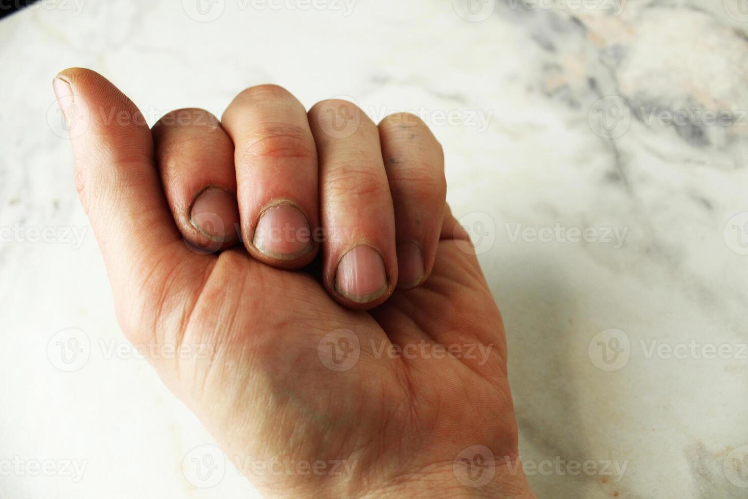 Left male hand with cuts and dirt close-up Right male hand photo