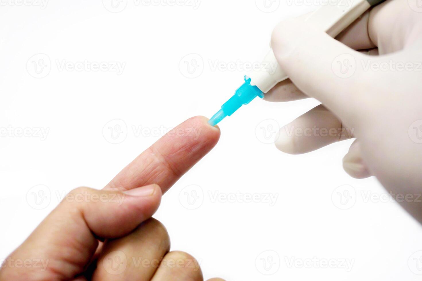 Hand of doctor in white medical glove holding needle pen stab on human forefinger to check glucose in bloods isolate on white background. photo
