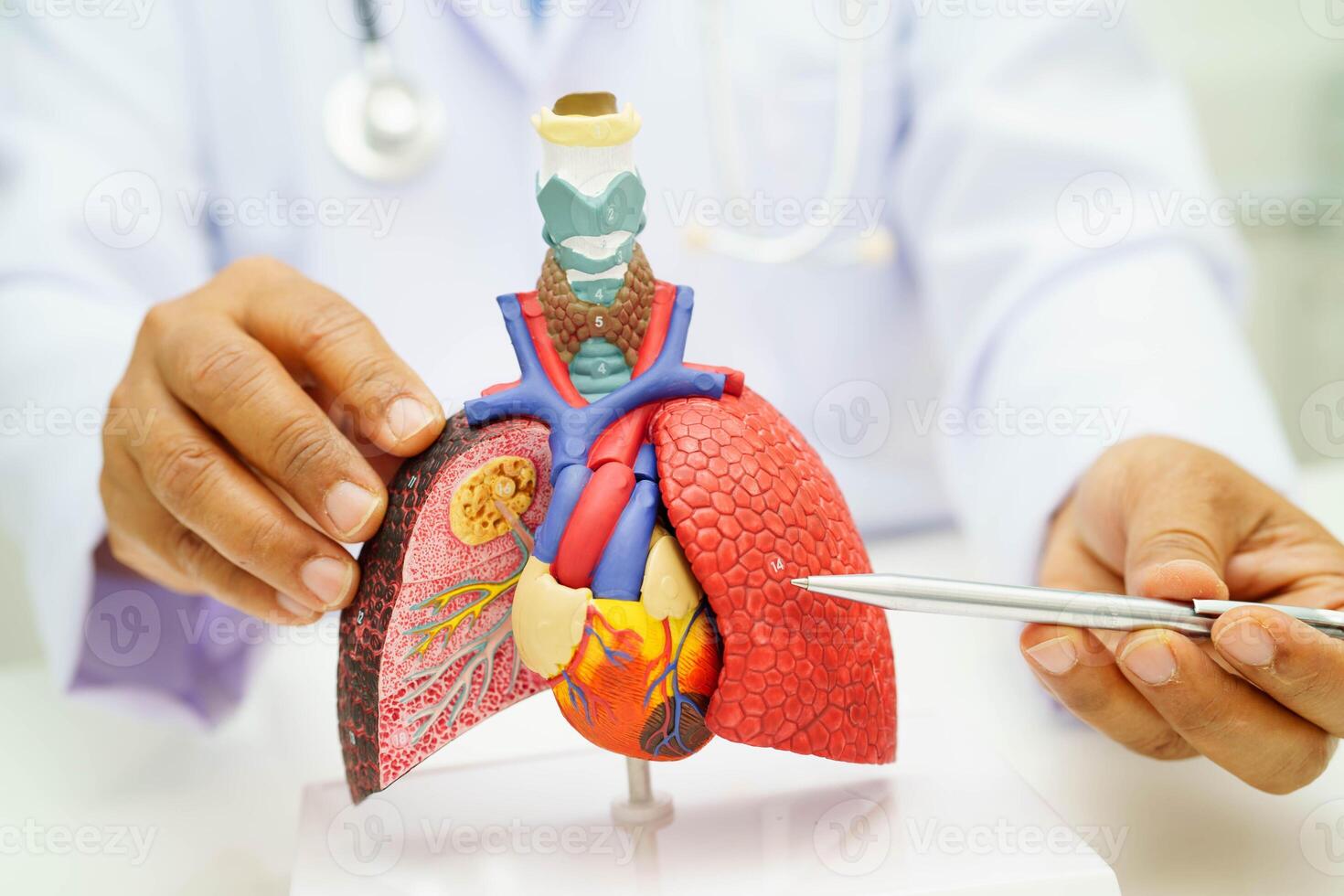 Cirrhosis, Liver cancer, fatty liver, Asian woman with liver human ana photo
