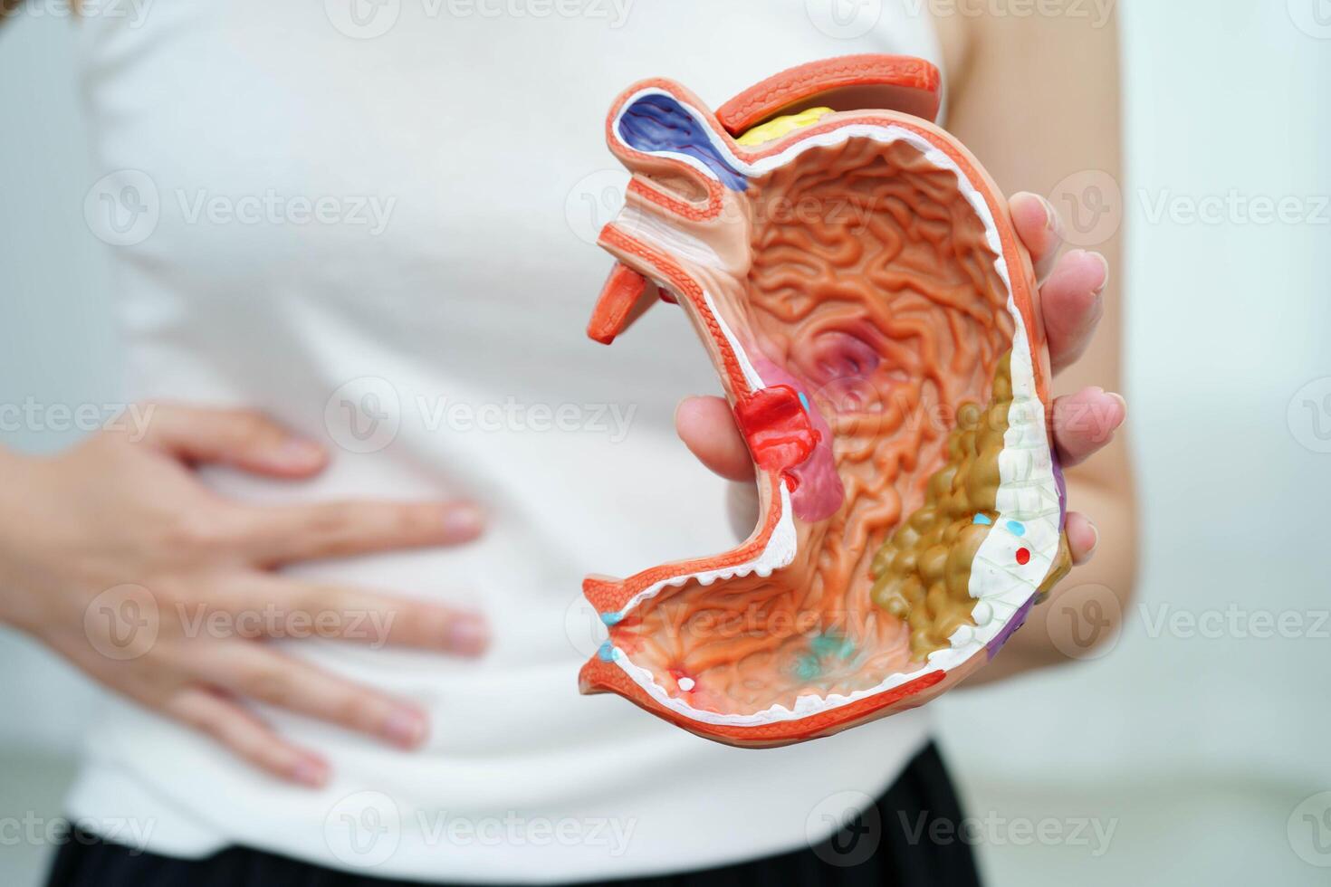 Stomach disease, Asian woman holding anatomy model for study diagnosis and treatment in hospital. photo