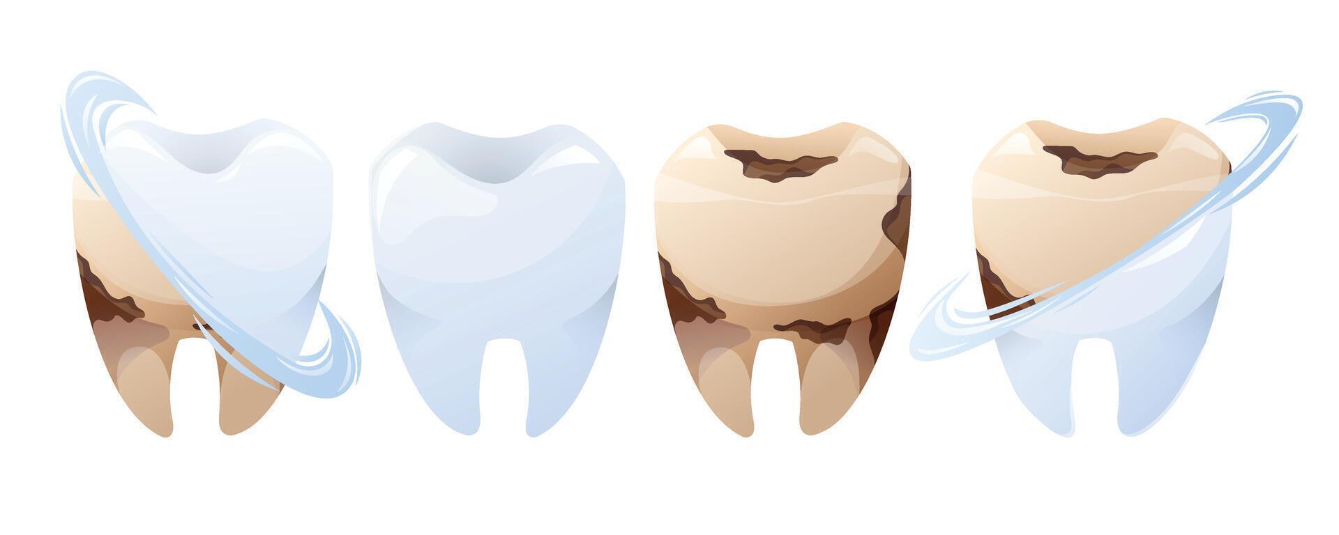cartoon isolated illustration set of clean and decayed teeth before and after treatment. Dental hygiene, oral care, cavity prevention for dentistry, medical infographics, and healthcare. vector