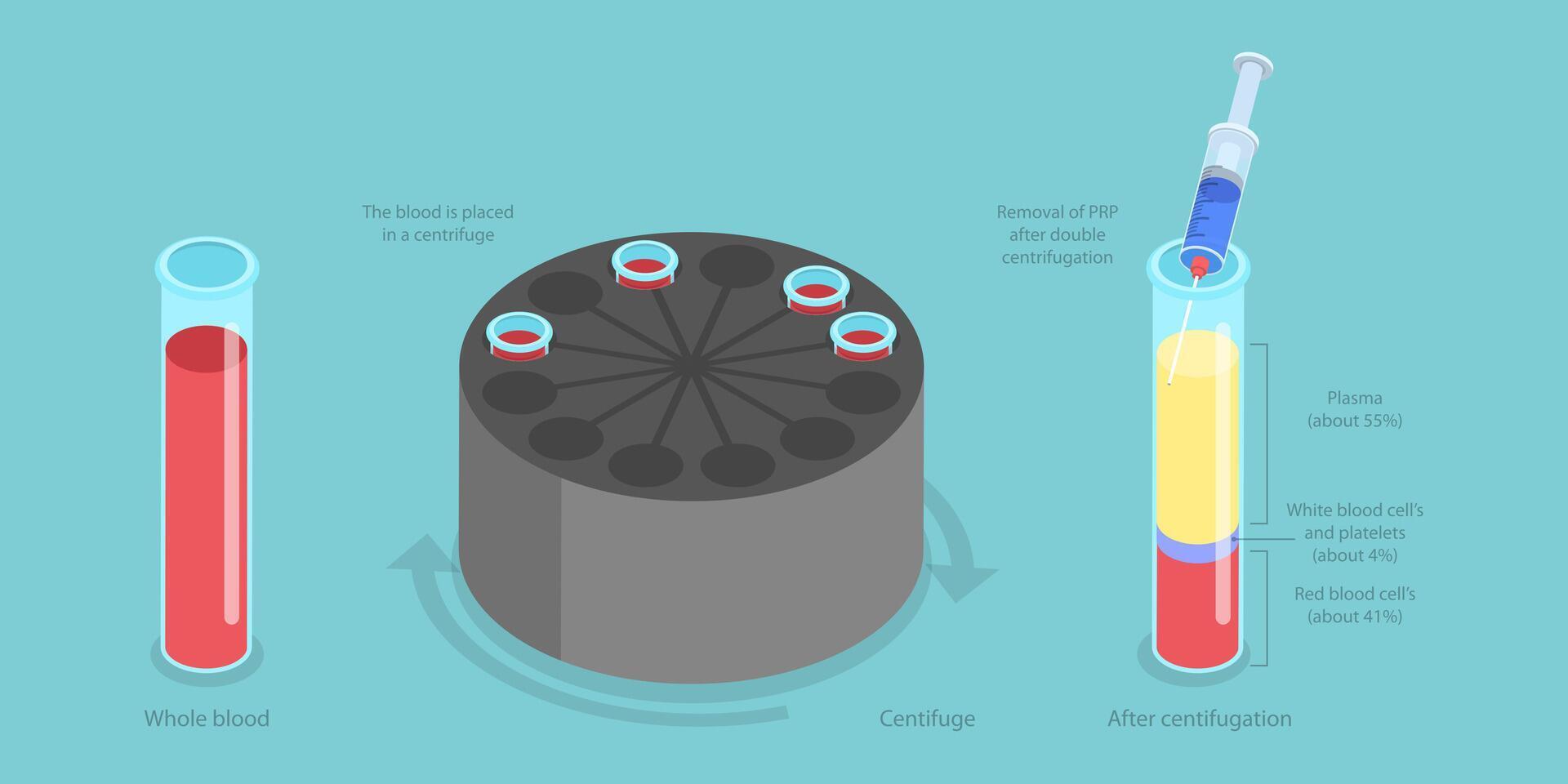 3D Isometric Flat Conceptual Illustration of Platelet-rich Plasma, Regenerative Medicine vector