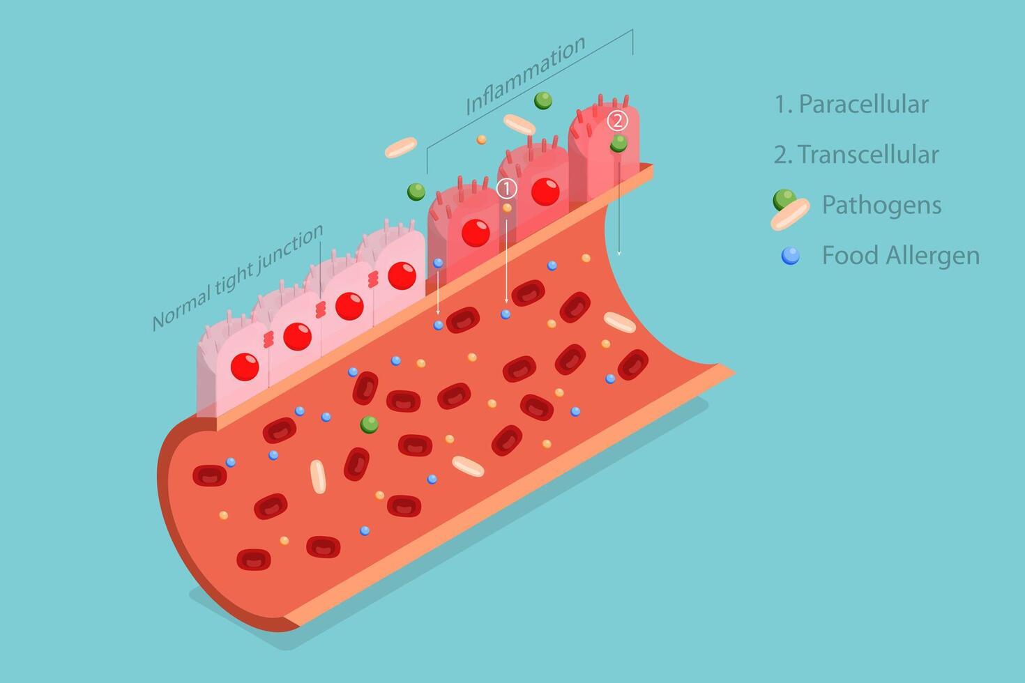 3D Isometric Flat Conceptual Illustration of Leaky Gut Syndrome, Autoimmune Disorder vector