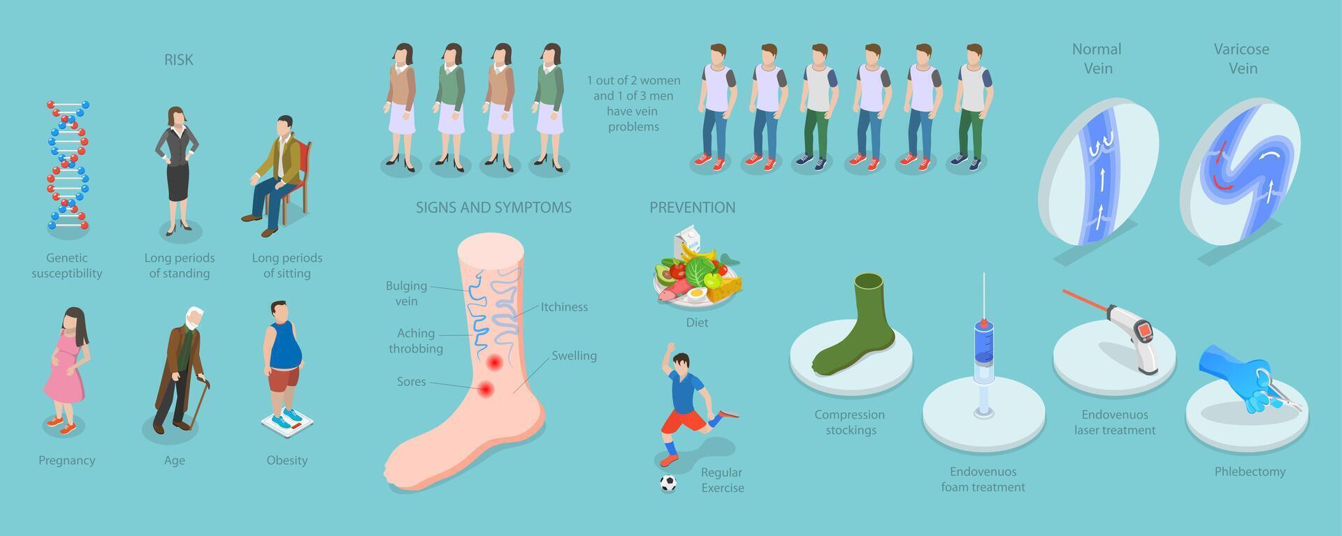 3D Isometric Flat Conceptual Illustration of Varicose Veins, Vascular Disease Diagnostic and Treatment vector