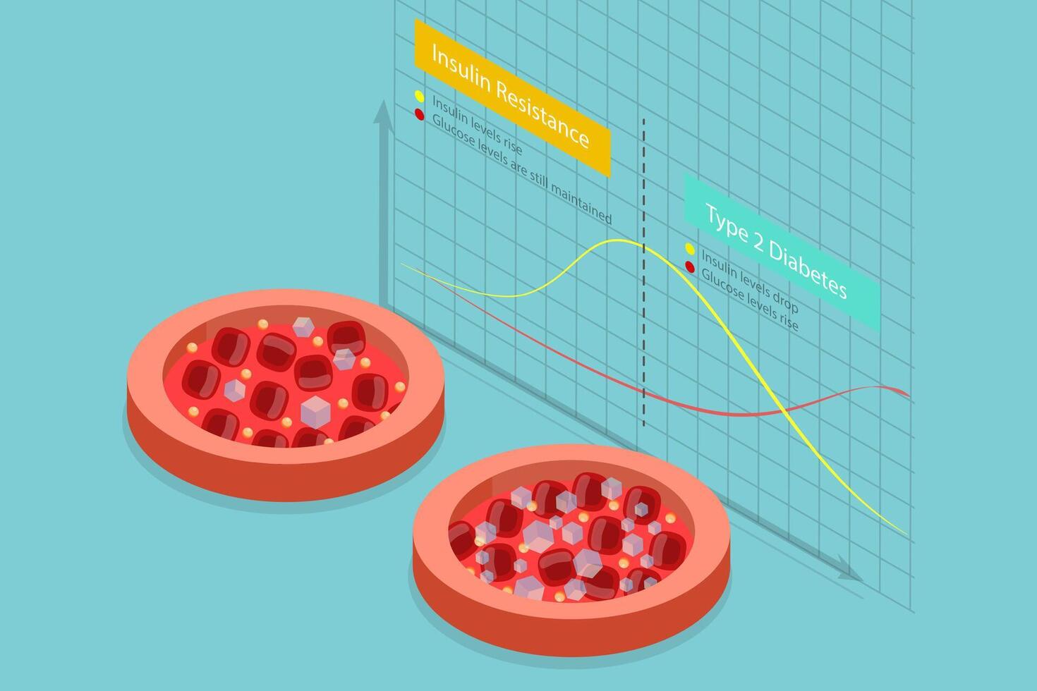 3D Isometric Flat Conceptual Illustration of Insulin Resistance, Comparision Chart vector