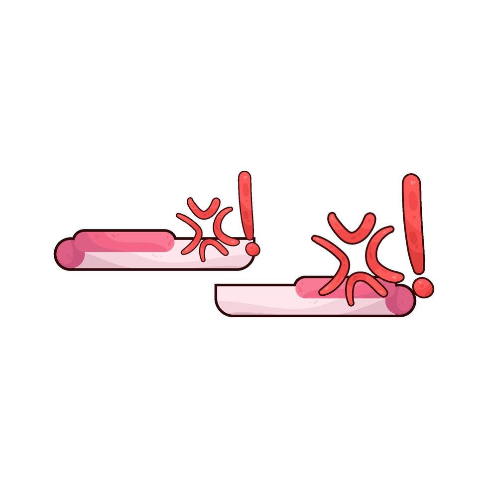illustration of angry chat vector