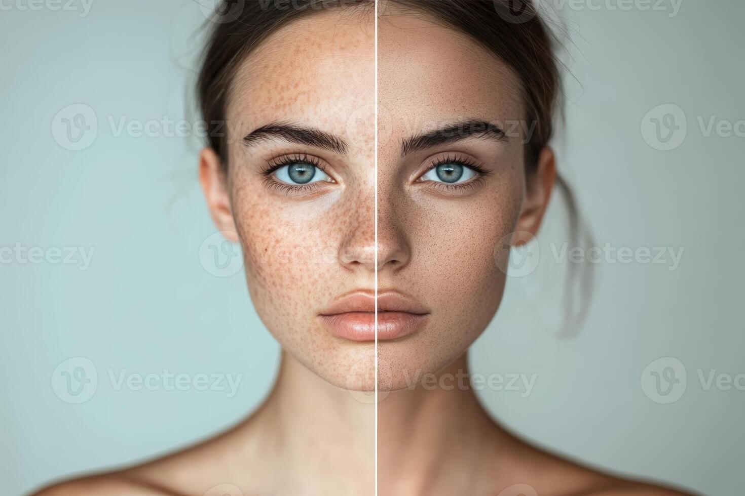 Woman showing before and after skin treatment results photo