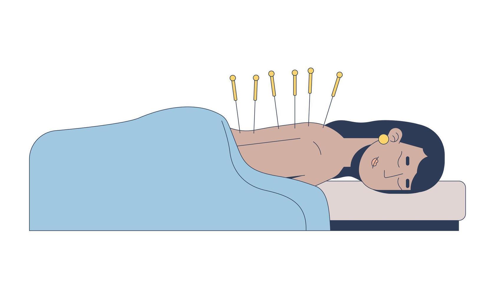 South asian woman receiving acupuncture therapy 2D cartoon character. Indian female lying on massage table under blanket with needles flat person isolated on white. Spot illustration colorful vector