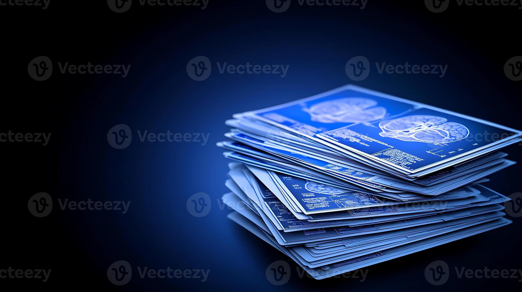 Stacked medical imaging reports showcasing detailed brain scans against a dark blue backdrop photo