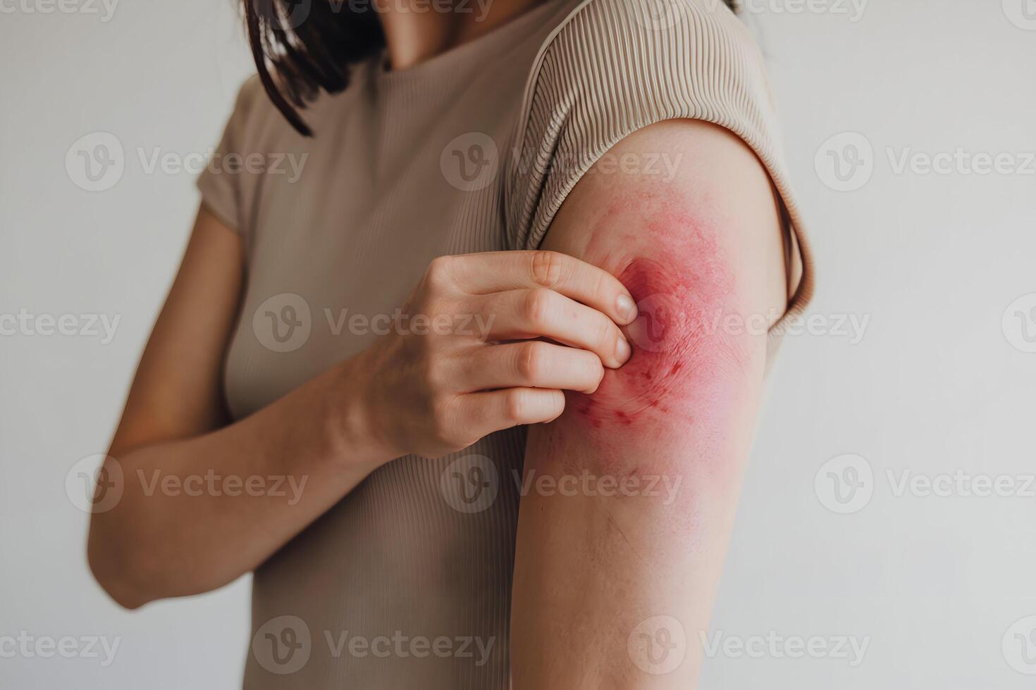 Woman scratches irritated arm, drawing attention to discomfort and skin sensitivity photo