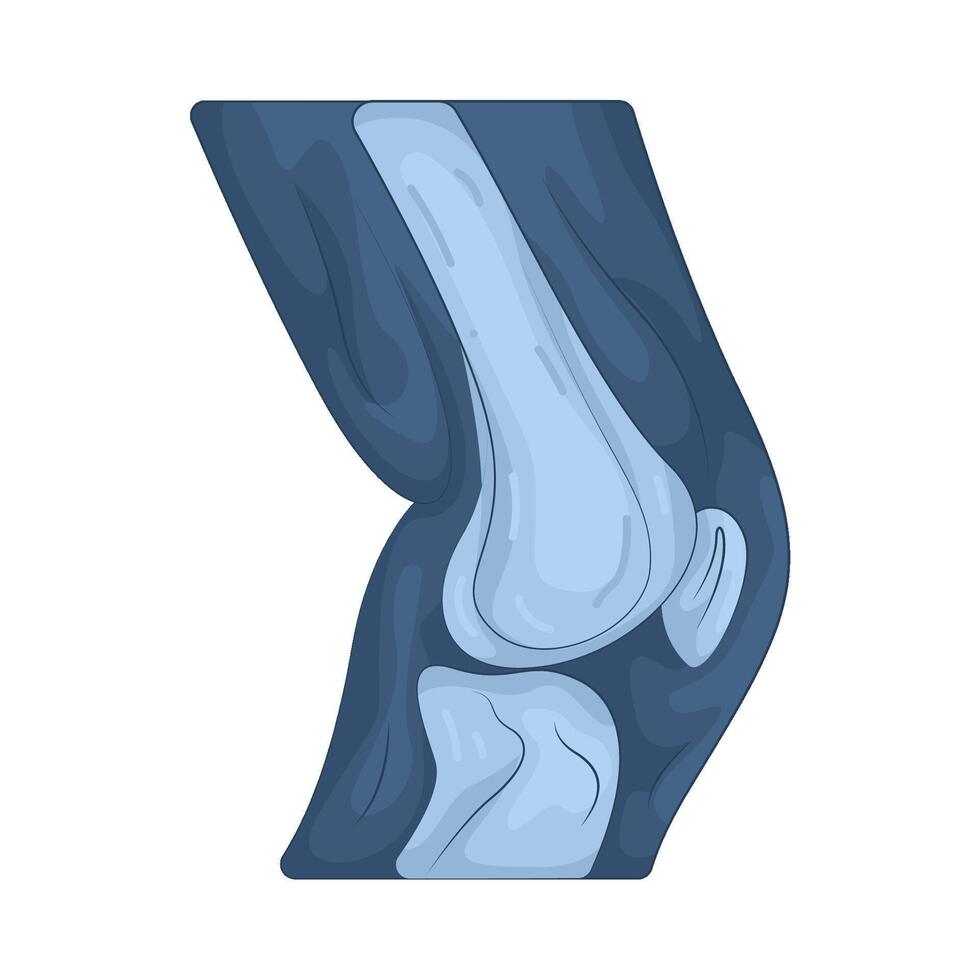 Illustration of knee X-Ray vector