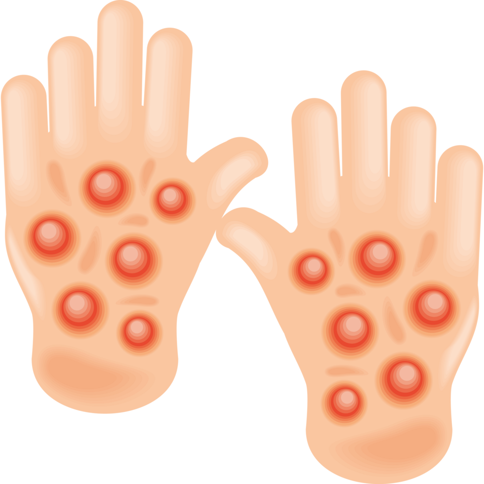 hands with monkeypox png
