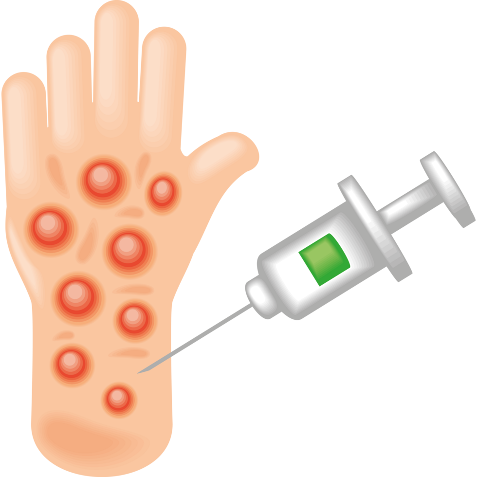 vaccination against monkeypox virus png