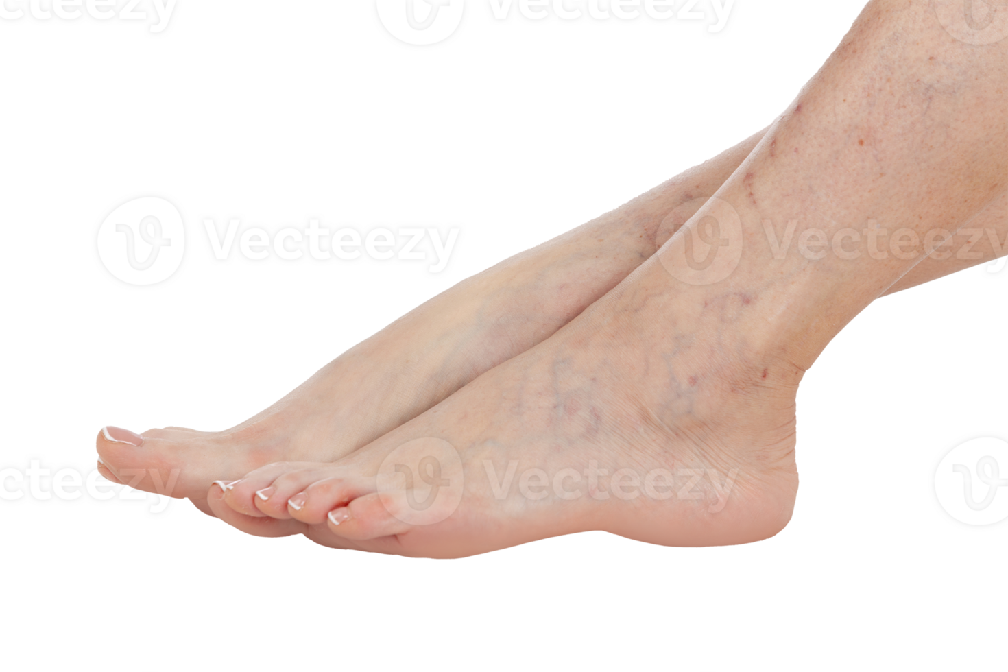 Female feet with vascular stars on the skin, isolated png