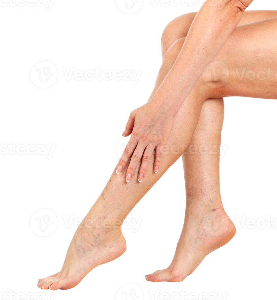 Female legs with vascular stars on the skin, isolated. Woman touches her shin with her hand png
