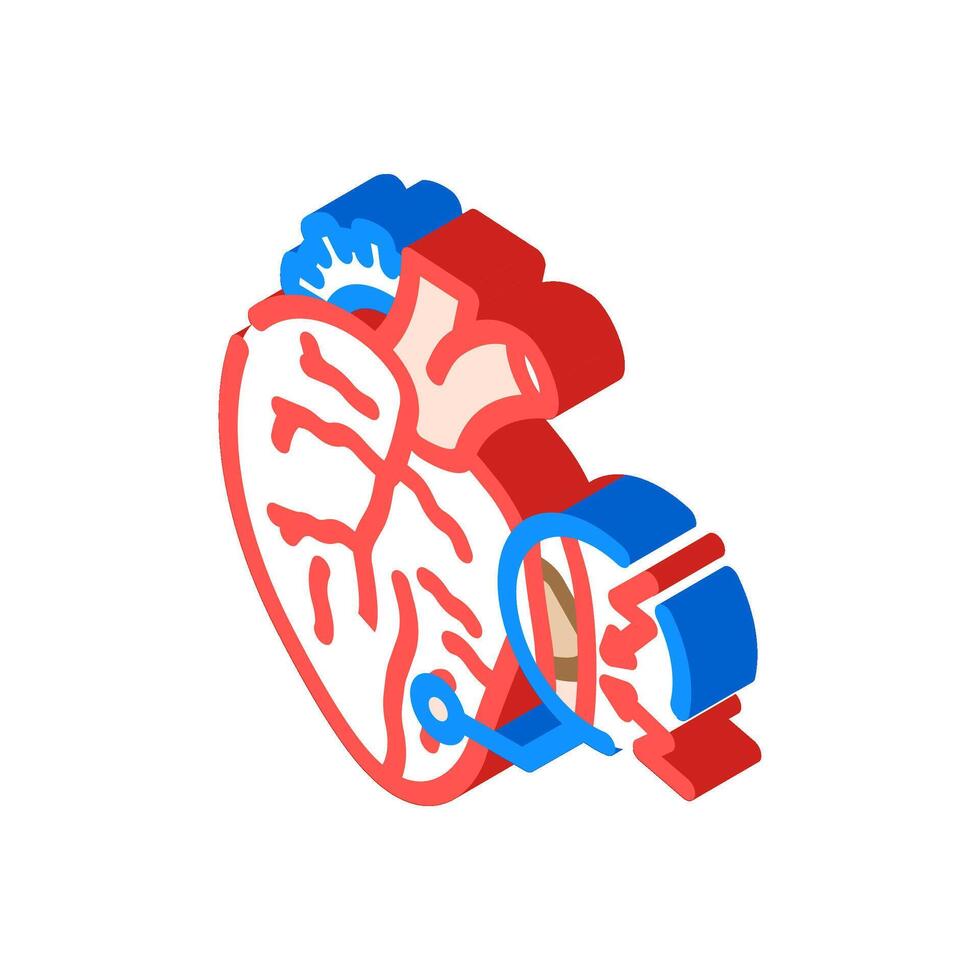 stroke caused cardiovascular issues isometric icon illustration vector