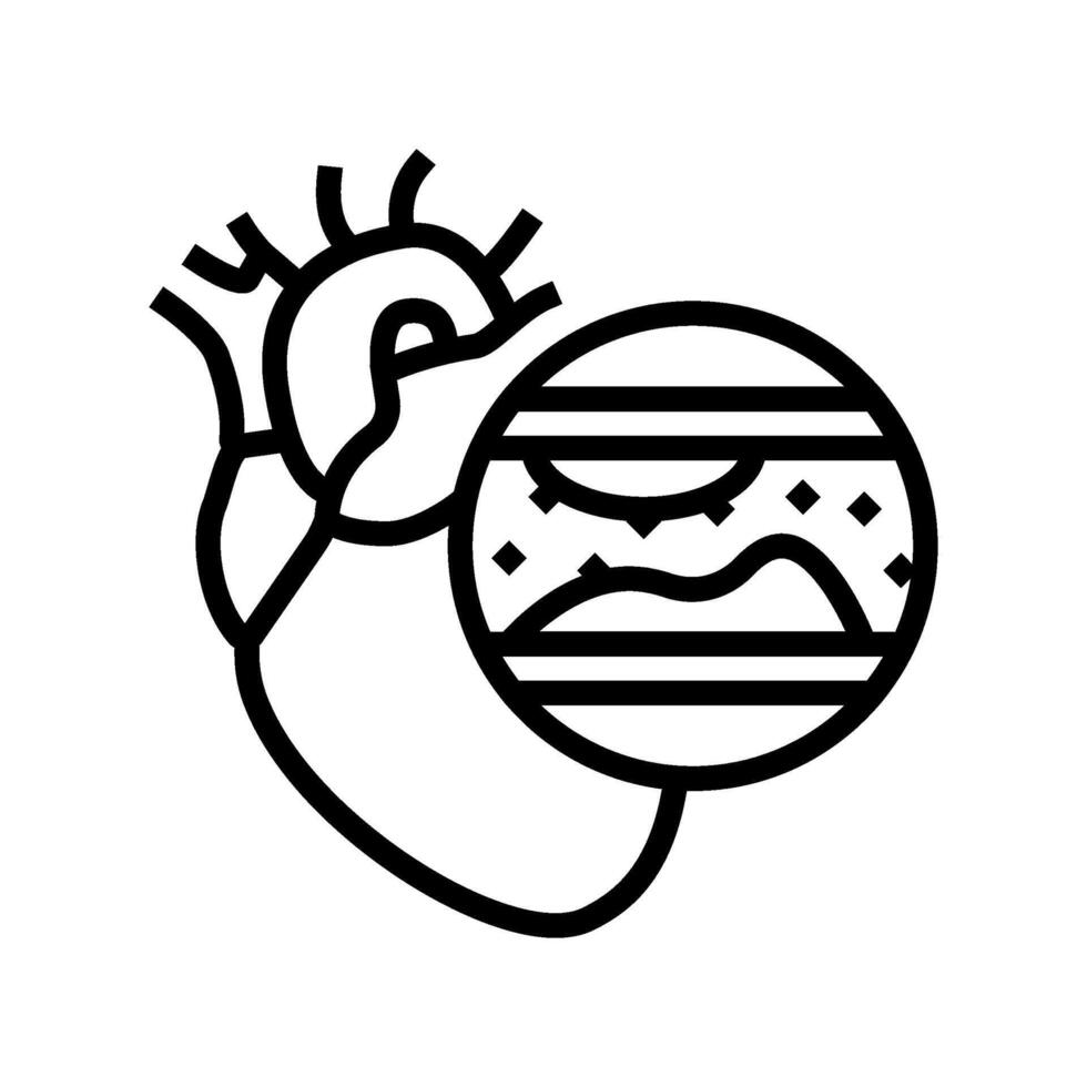 atherosclerosis cardiology disease line icon illustration vector